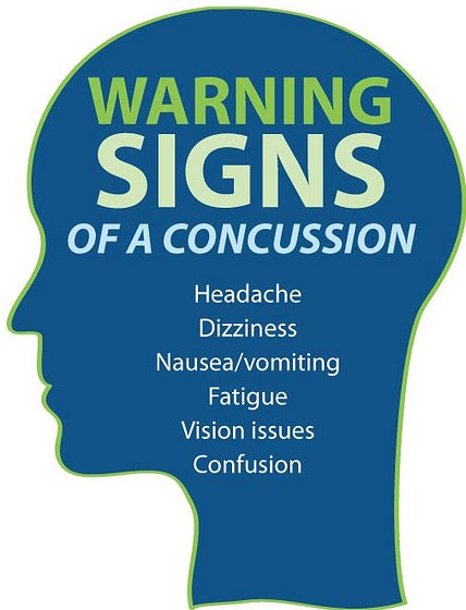 Warning Signs of a Concussion